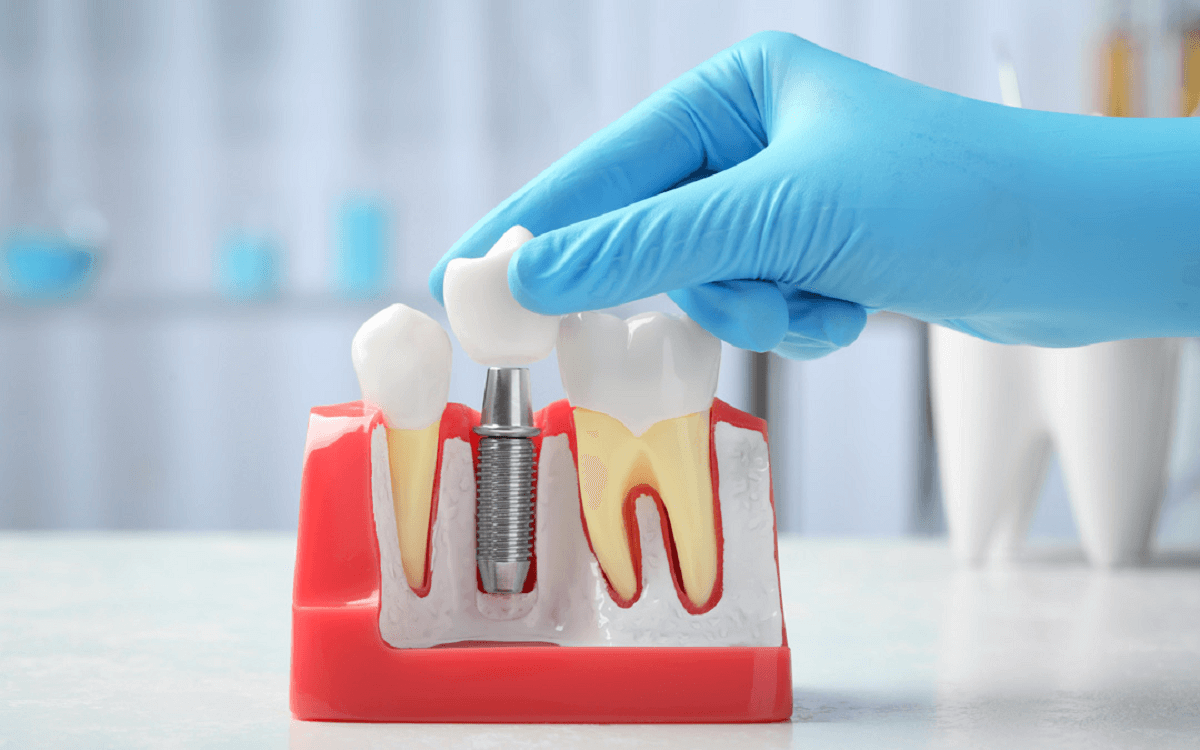 New Dental Technology