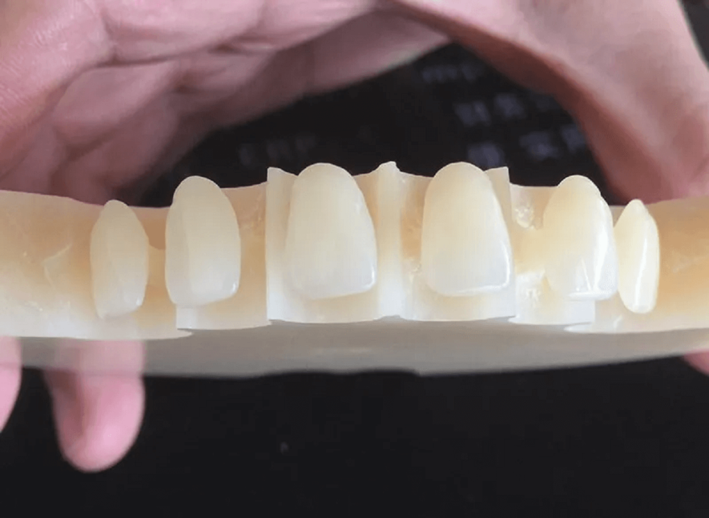 PMMA Dental Material
