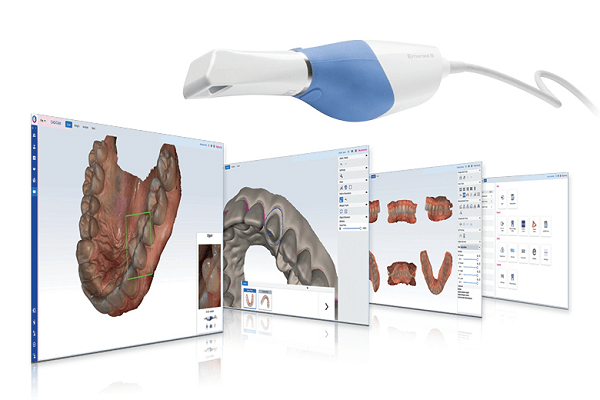 Planmeca CAD CAM digital dental solution