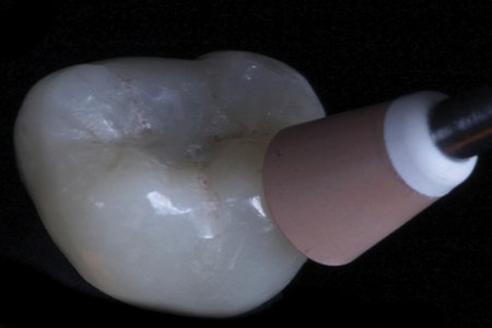 Polishing zirconia techniques