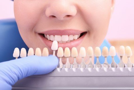 Right dental implant color for shade matching