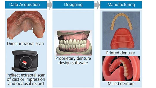 Step-by-Step Process of Denture Fabrication