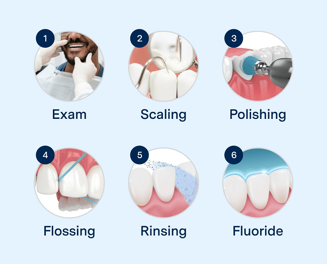 Steps of Dental Cleaning Procedure