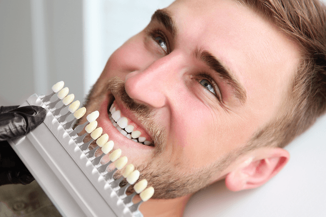 The images shows the color matching process during dental teeth whitening to match the exact color with natural appearance