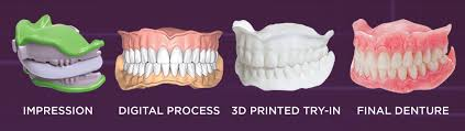 The process of making 3d printed dentures