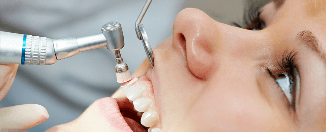 Tips for Zirconia polish