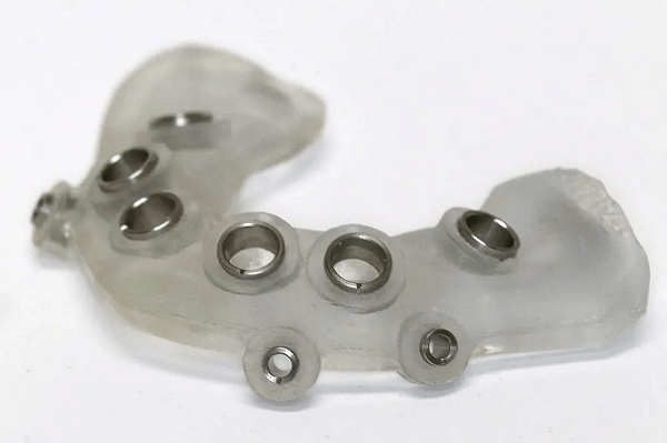 Tissue-supported Surgical Implant Guide