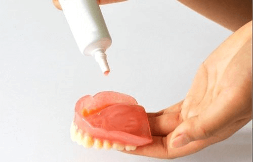 Types of Dental Adhesives