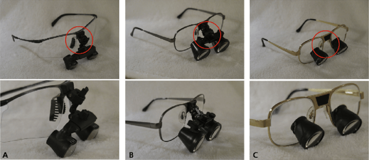 Types of Dental Loupes
