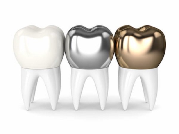 Types of material for temporary crowns