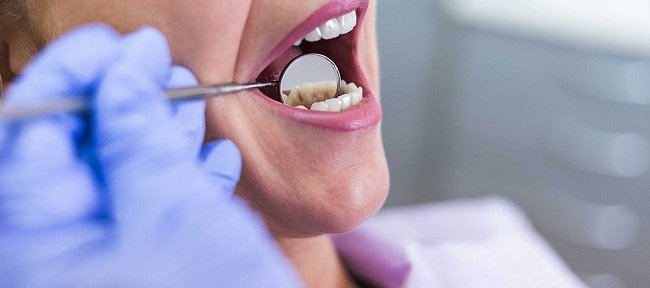 Types of oral surgery