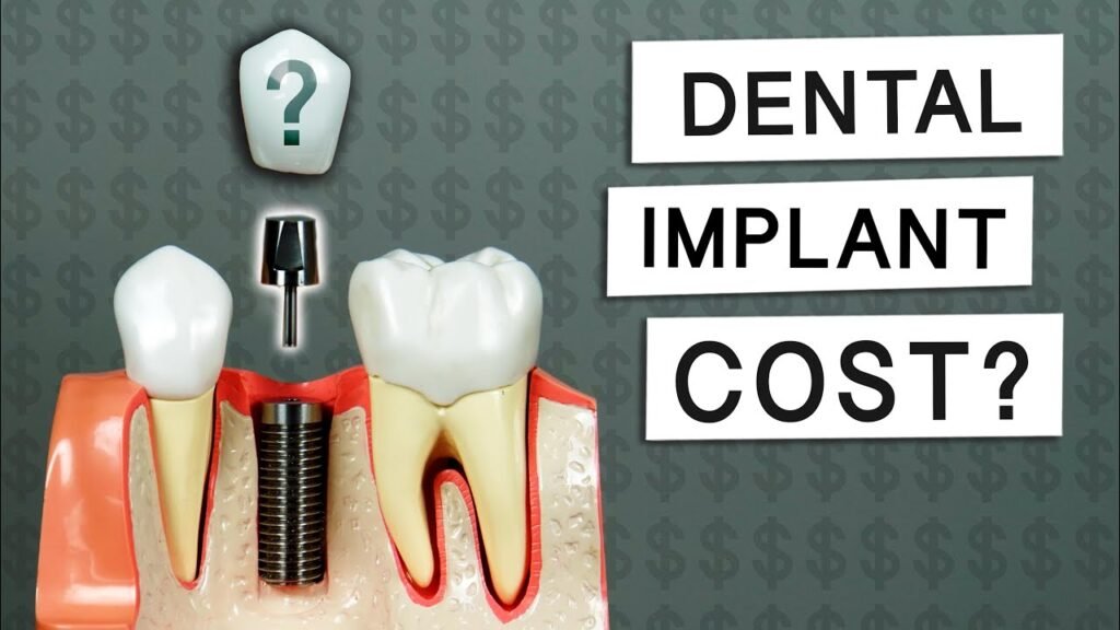 Understanding Dental Implants Cost