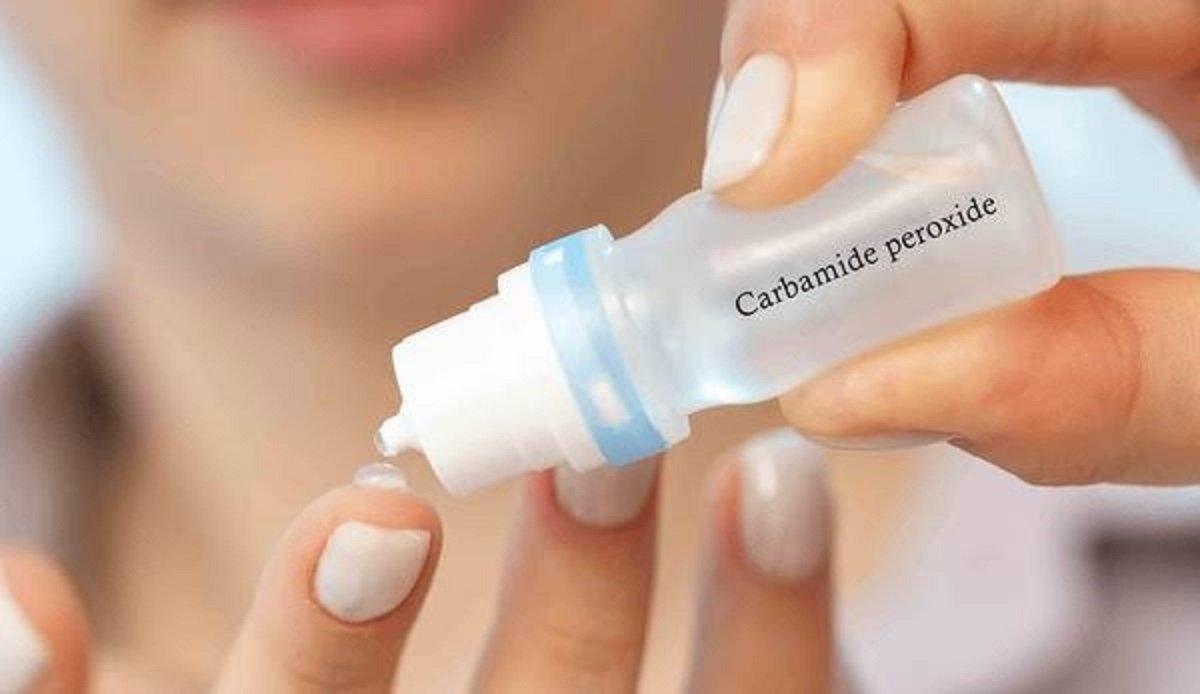Use of Carbamide Peroxide Dental Solution