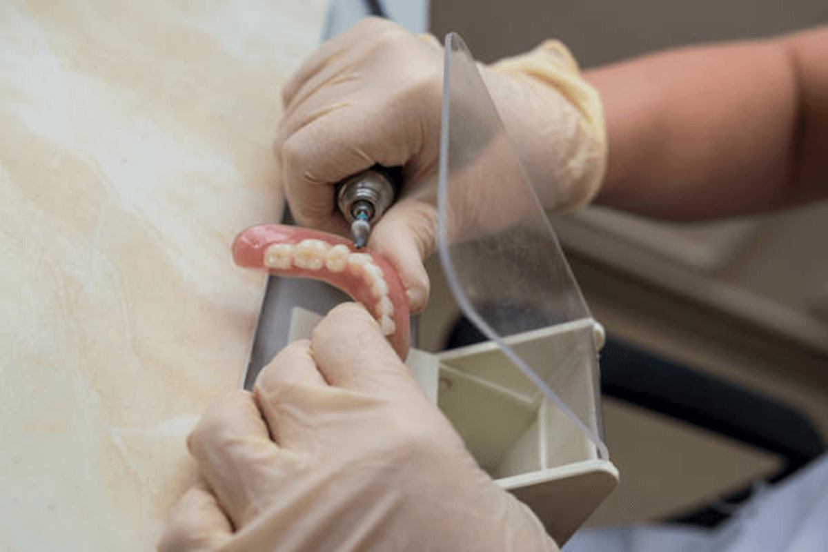 Visual Representation of Grinding and Polishing Tooth