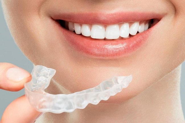 Vivera Retainers