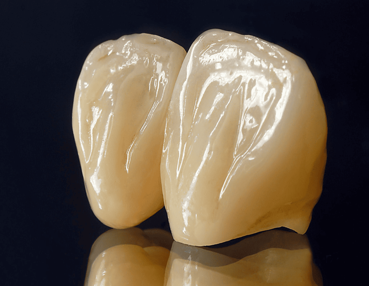 Well-polished zirconia restorations using zirconia polishing burs