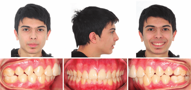 Why Intraoral and Extraoral Photographs Matter in Modern Dentistry