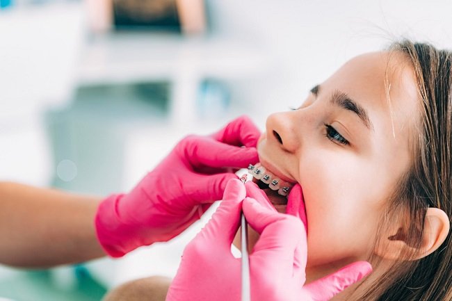 Why Orthodontics for Kids Matters