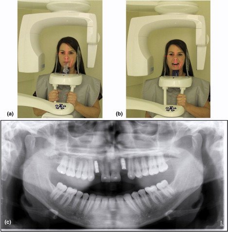 X-ray machines take images of the skull to track jaw position and jaw growth
