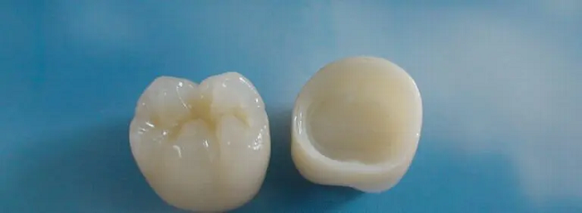 Zirconia Crown