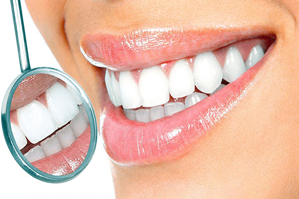 Zirconia Veneers