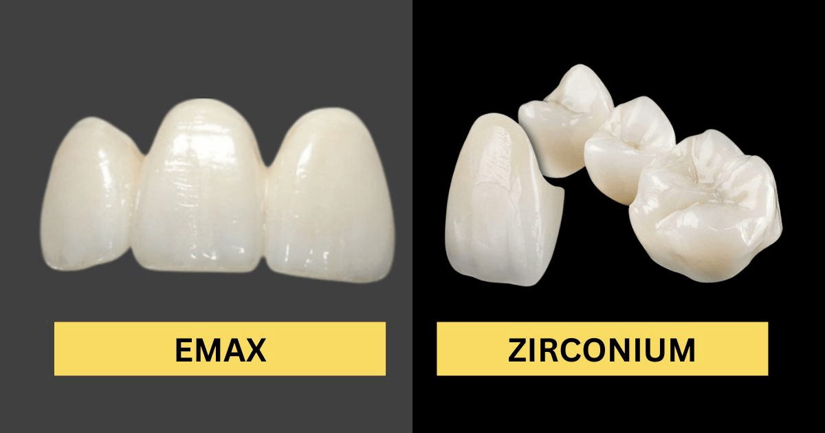 Zirconia vs Emax Veneers