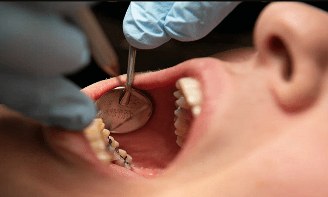 dental checkup