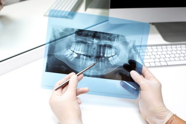 dentist holding an x-ray