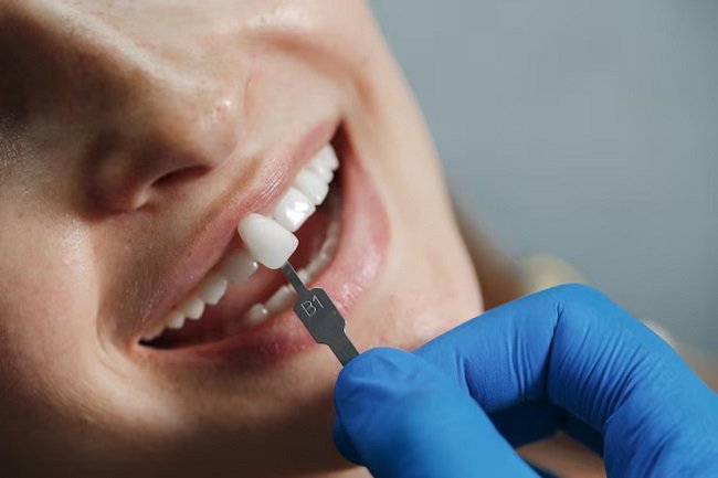 dentist matching the tooth color