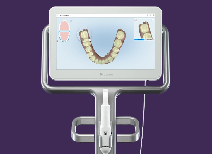 iTero Element Intraoral Scanner