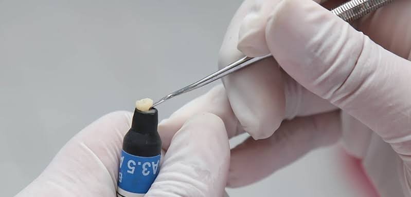 the dental material for restorations