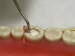 Efficient dental surgery
